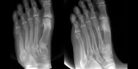 Traditional X-Ray X ray imaging in the Broward County, FL: Tamarac (Margate, Palm Aire, Coral Springs, Parkland, Coconut Creek, Sunrise, Lauderdale Lakes, Plantation, Lauderhill, Oakland Park, Wilton Manors, Pompano Beach, Hollywood, West Park, Miramar, Hallandale Beach) and Miami-Dade County, FL: North Miami Beach (Opa-locka, Westview, Palm Springs North, Miami Lakes, Miami Gardens, Aventura) and Miami (Fisher Island, Miami Beach, Coral Gables, Westchester, Hialeah, Key Biscayne, Fontainebleau) areas