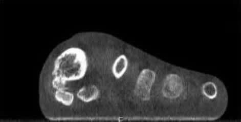 PedCAT & 3D Volume Imaging Advanced Diagnostics and Treatment in the Broward County, FL: Tamarac (Margate, Palm Aire, Coral Springs, Parkland, Coconut Creek, Sunrise, Lauderdale Lakes, Plantation, Lauderhill, Oakland Park, Wilton Manors, Pompano Beach, Hollywood, West Park, Miramar, Hallandale Beach) and Miami-Dade County, FL: North Miami Beach (Opa-locka, Westview, Palm Springs North, Miami Lakes, Miami Gardens, Aventura) and Miami (Fisher Island, Miami Beach, Coral Gables, Westchester, Hialeah, Key Biscayne, Fontainebleau) areas