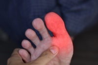 Foot Problems Mistaken for Bunions