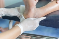 Various Reasons Why Wounds Develop on the Feet